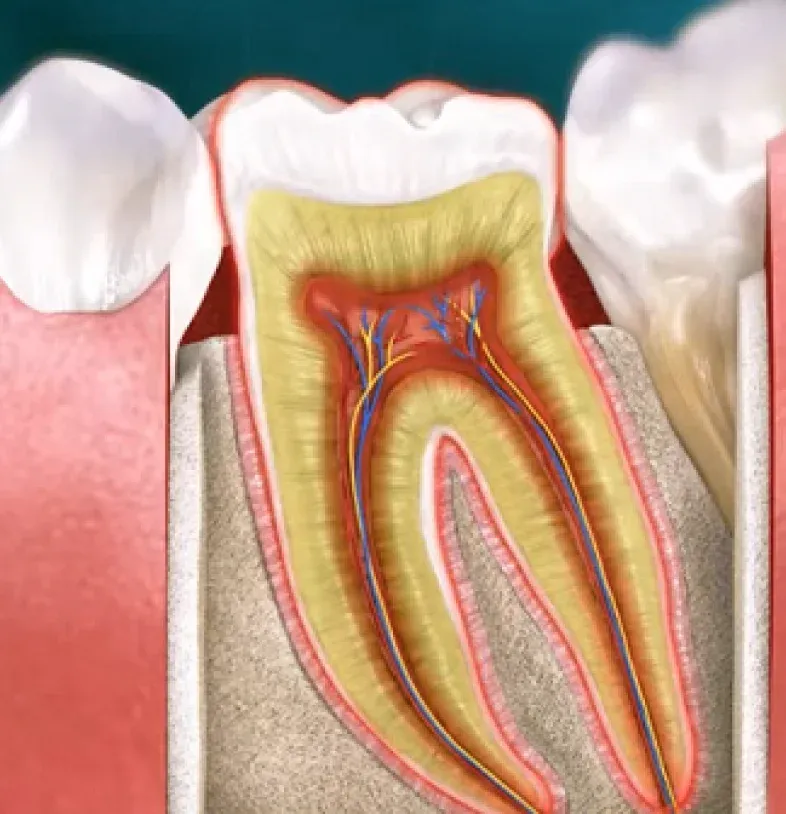 Dental Crown Types